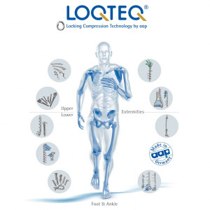 LOQTEQ® Anatomical Plating System