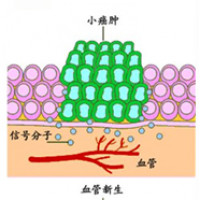 Antiangiogenesis